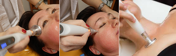 Jett Plasma Lift Medical